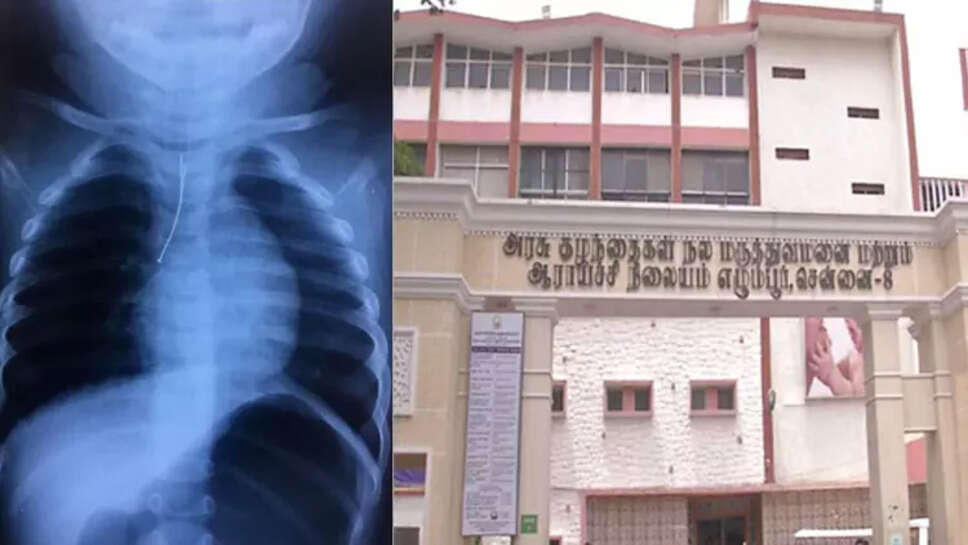 எக்மோர் குழந்தை மருத்துவமனை