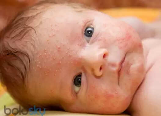 எண்ட்ரோவைரஸ்