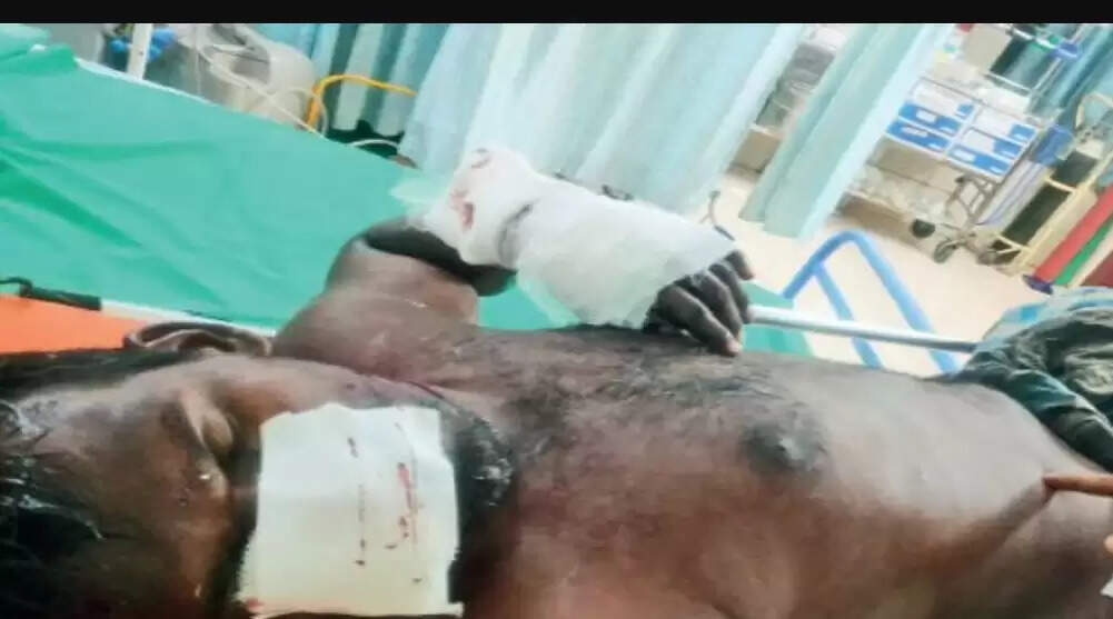 நாய்க்கடி நாய் கடி