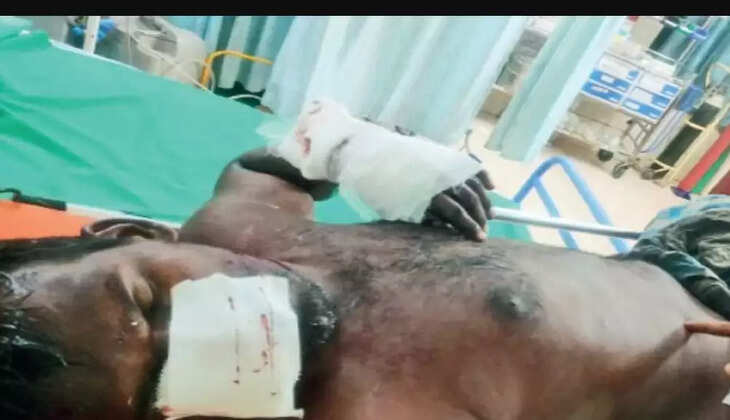 நாய்க்கடி நாய் கடி