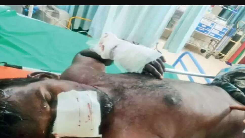 நாய்க்கடி நாய் கடி