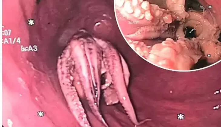 ஆக்டோபஸ் 