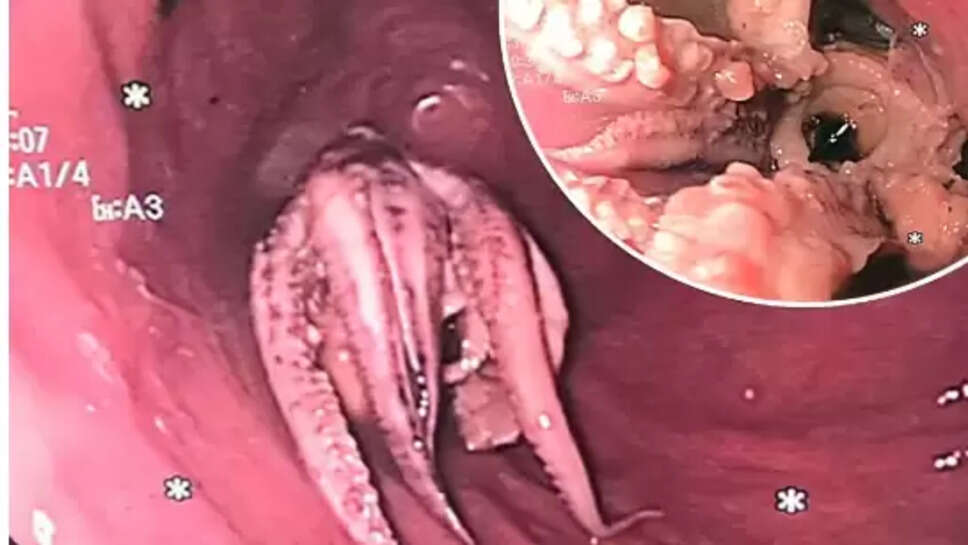 ஆக்டோபஸ் 