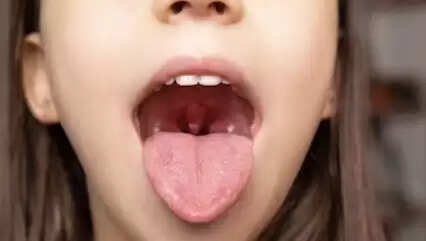 புற்றுநோய்