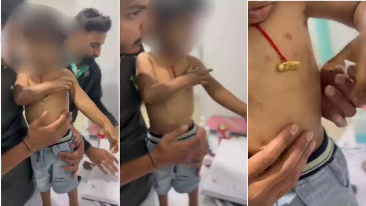 அடிப்பட்ட சிறுவன்