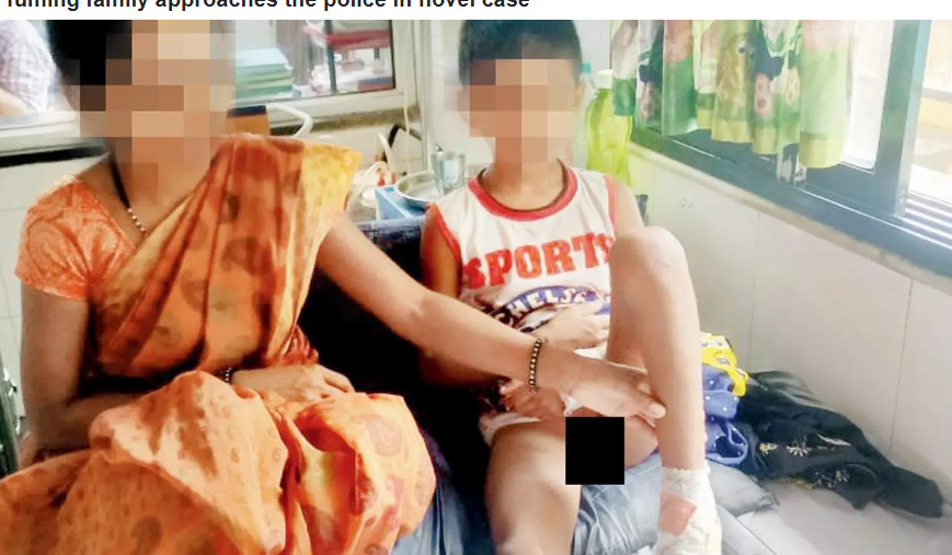 அதிர்ச்சி... கால் அறுவை சிகிச்சைக்காக சென்ற சிறுவனுக்கு விருத்தசேதனம் செய்த மருத்துவர்கள்!