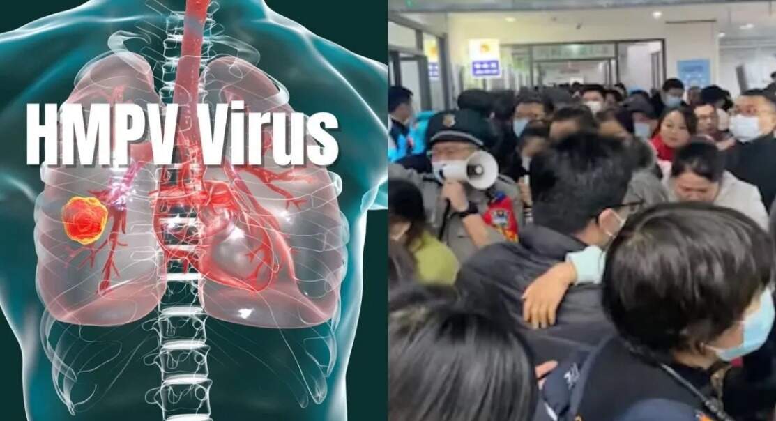 கதறும் சீனா... வேகமெடுக்கும் ஹெச்எம்பிவி வைரஸ்.. தடுப்பூசியும் கிடையாது... என்னென்ன அறிகுறிகள்? சிகிச்சை முறைகள்!