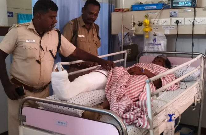 உடுமலை அருகே பயங்கரம்... தோட்டத்திற்குள் புகுந்து பெண்ணைத் தாக்கிய காட்டுப்பன்றி.. கால்முறிவு.. மருத்துவமனையில் அனுமதி!