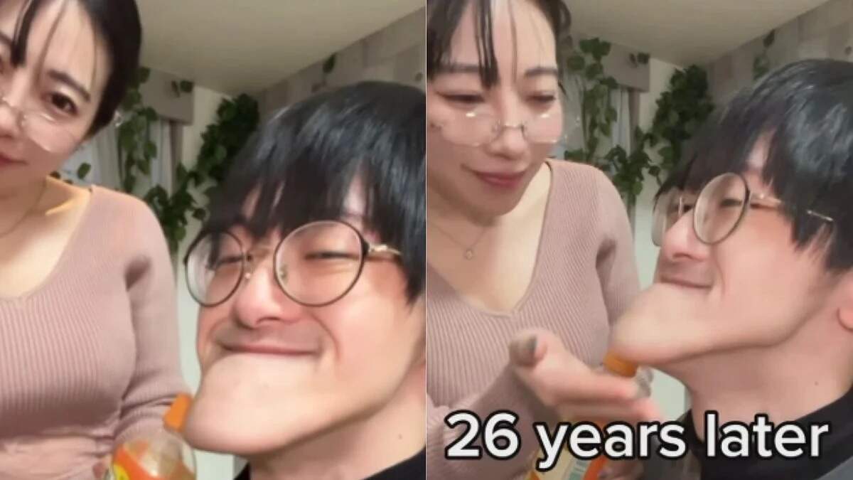 வைரல் வீடியோ... உலகிலேயே மிக மிக நீளமான தாடை கொண்ட இளைஞர் .... விட்டுச்சென்ற காதலி!