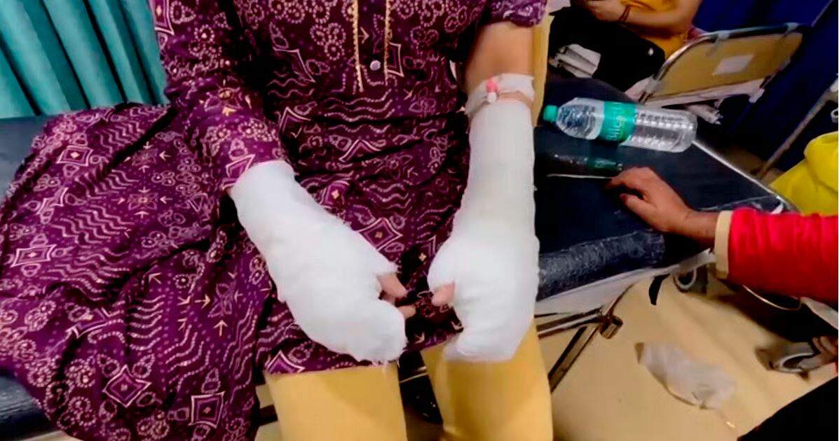 அடுத்த அதிர்ச்சி... காதலை நிராகரித்த கல்லூரி மாணவி மீது ஆசிட் வீச்சு!