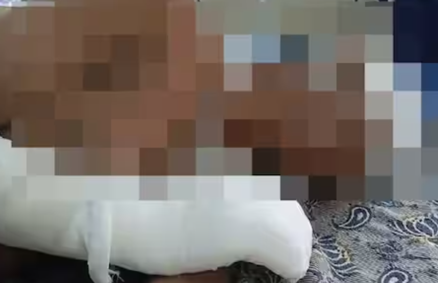 பரபரப்பு... கல்லூரி மாணவர்களிடையே மோதல்.. ஒருவர் படுகாயம்!