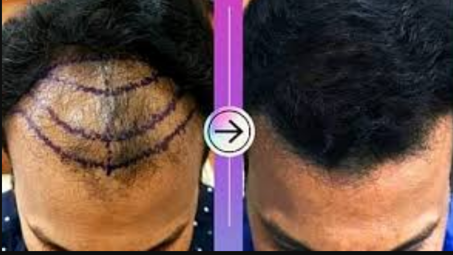 ஹேர் மையங்களுக்கு கடும் கட்டுப்பாடுகள்... சுகாதாரத் துறை அதிரடி !