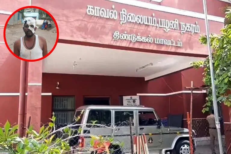 11 பேரை சுற்றி வளைத்து தட்டித் தூக்கிய காவல்துறை.. ரவுடிகளைக் களையெடுக்கும் பணியில் போலீசார்!