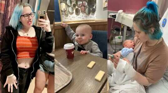 அப்பெண்டிக்ஸ் சிகிச்சைக்கு சென்ற கல்லூரி மாணவி.. எதிர்பாரத விதமாக பிறந்த குழந்தையால் அதிர்ச்சி..!