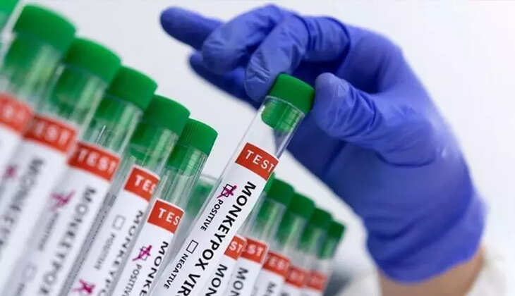 குரங்கம்மை குரங்கு அம்மை