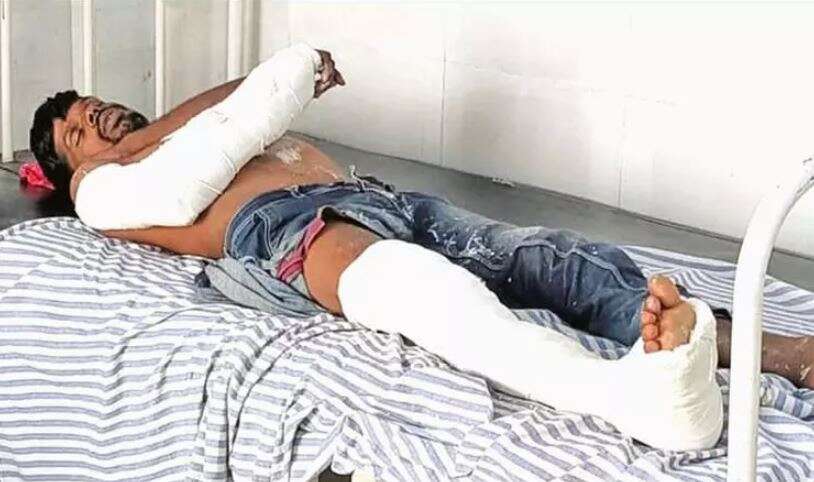 கோவில் காவலாளிகள் கொலை வழக்கில் கைதனாவருக்கு கை, காலில் மாவுக்கட்டு!