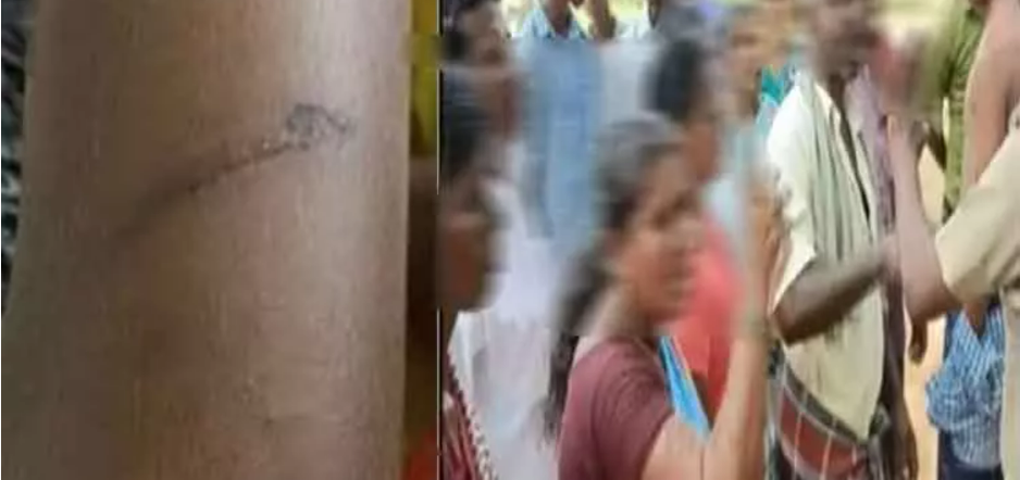 72 மாணவர்களுக்கு சராமாரி அடி!! உதவி தலைமை ஆசிரியர் பணி இடை நீக்கம்!!!