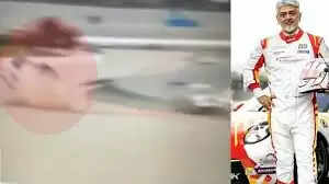 ‘இவ்வளவு ரிஸ்க் எடுக்கணுமா?’ பதறும் ரசிகர்கள்... கார் ரேஸில் நடிகர் அஜித் மீண்டும் உயிர் தப்பினார்!