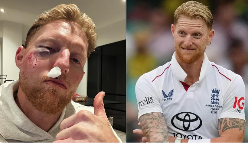 பயிற்சியில் பென் ஸ்டோக்ஸ் முகத்தில் பந்து பட்டு படுகாயம்!