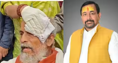 நாடாளுமன்ற வளாகத்தில் பரபரப்பு... மேலும் ஒரு பாஜக எம்.பி. படுகாயம்... மருத்துவமனையில் ஐசியூவில் அனுமதி!