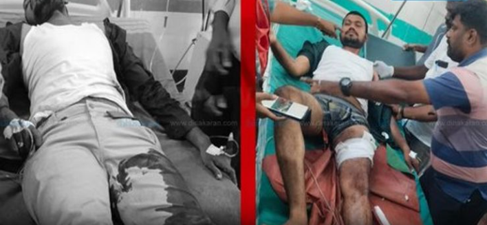 ரௌடி தப்ப முயற்சித்த போது சுட்டுப் பிடித்த போலீஸ்!