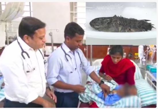 அதிர்ச்சி... 11 மாத குழந்தையின் தொண்டையில் சிக்கிய 2 உயிருள்ள மீன்கள்!