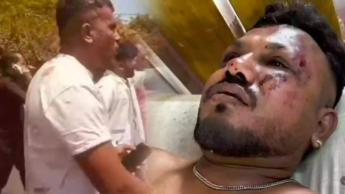 ஏர் இந்தியா விமான விபத்தில் ஒருவர் உயிரோடு மீட்பு!