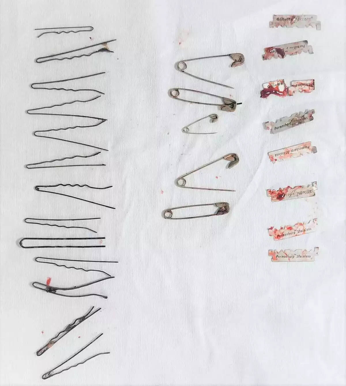 இளைஞரின் வயிற்றில் 13 ஹேர்பின், 4 சேப்டிபின், 6 பிளேடு!!அதிர்ச்சி!!