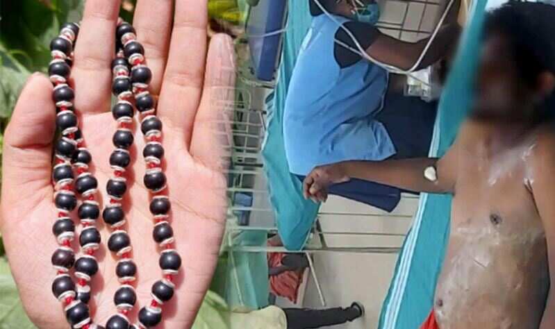 ஆசையாசையாய் கருங்காலி மாலை வாங்க சென்ற வாலிபர்... மேலே ஆசிட் ஊற்றி அதிர வைத்த கடைக்காரர்!