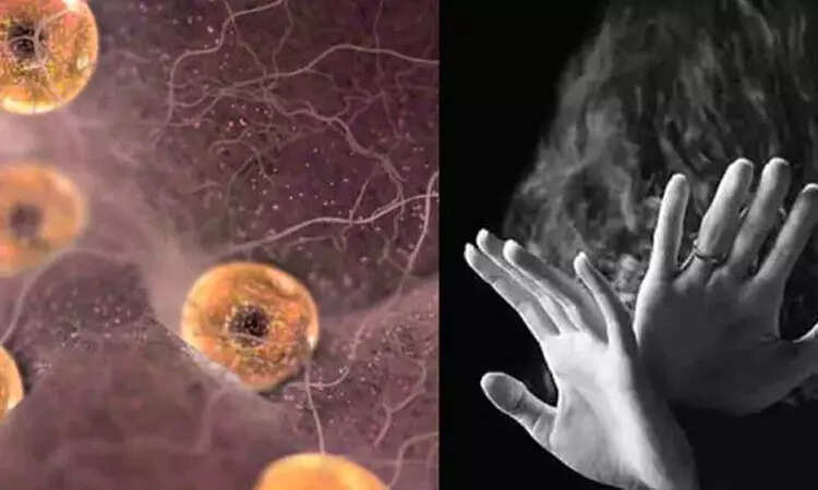 கருமுட்டை