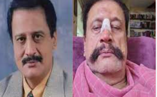 அதிர்ச்சி... பிரபல நடிகர் மீது கொலைவெறித் தாக்குதல்... கண், மூக்கு, கால்களில் படுகாயம்!!