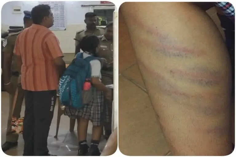 4 ம் வகுப்பு மாணவியை கை, கால்களில் சராமாரியாக அடித்து நொறுக்கிய ஆசிரியை!!