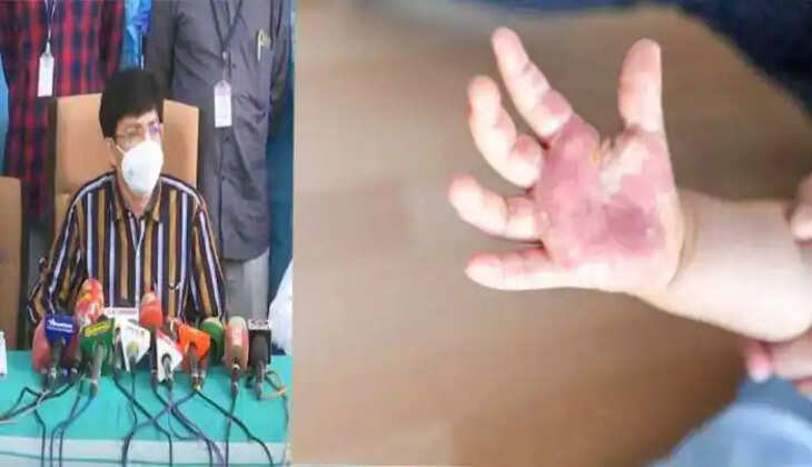 ராதாகிருஷ்ணன் தக்காளி வைரஸ்